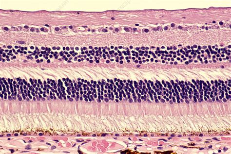 Histology of normal retina - Stock Image - P424/0213 - Science Photo Library