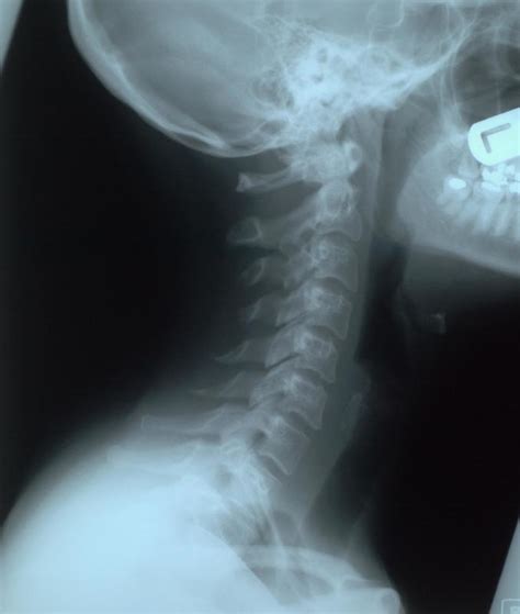 Neck X-ray — Science Learning Hub