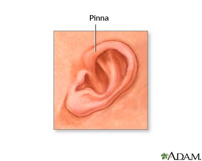 Pinna of the newborn ear: MedlinePlus Medical Encyclopedia Image