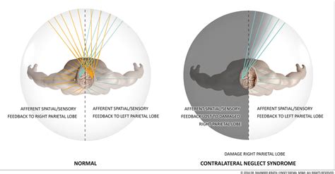 Activation Of The Sympathetic Nervous System Causes Bronchodilation ...