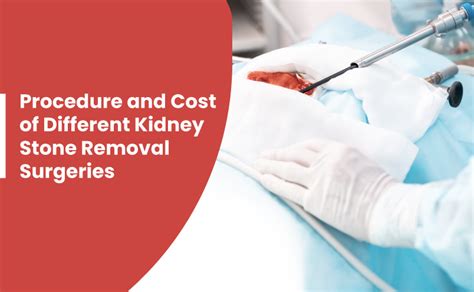 Procedure & Cost of Different Kidney Stone Removal Surgeries