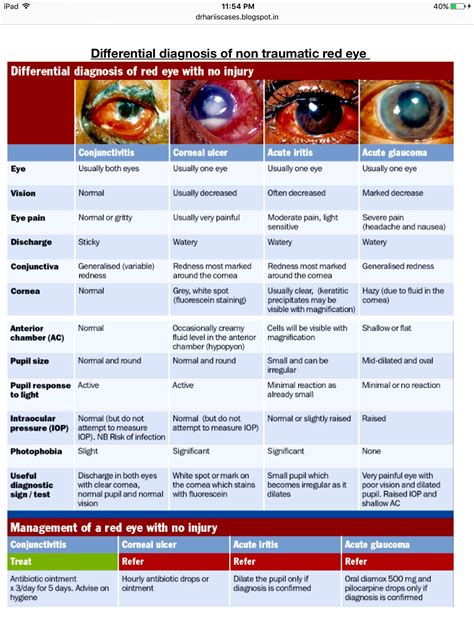 Allergic conjunctivitis symptoms types causes and treatment – Artofit