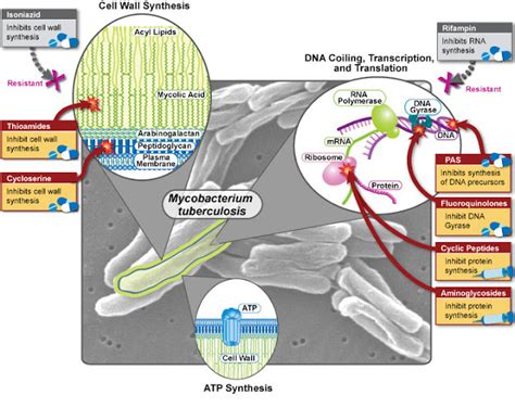 Multidrug-Resistant Tuberculosis (MDR-TB) - Dream Health