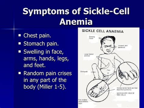 Period 3/Anthony Davis/Sickle-Cell Anemia