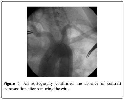 vascular-medicine-surgery-aortography