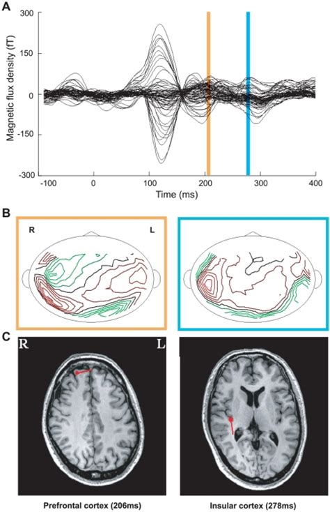 A. A typical example of gustatory imagery-induced magnetic fields. B.... | Download Scientific ...