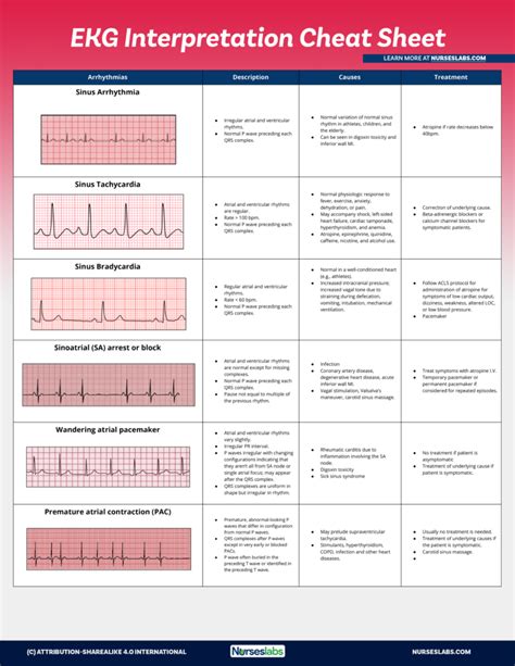 Cardiac Ecg Flashcards Pdf Anatomy Flashcards Flashcards Sinus Rhythm ...