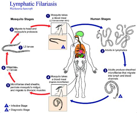 Wuchereria bancrofti life cycle. | Download Scientific Diagram