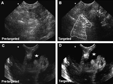 The enhancement in ultrasound signal intensity from spontaneous ovarian... | Download Scientific ...