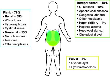 Approach to Abdominal Masses | SpringerLink