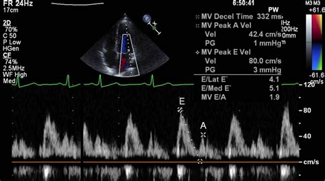 Transthoracic Echo | Cardiac sonography, Echocardiogram, Sonography student