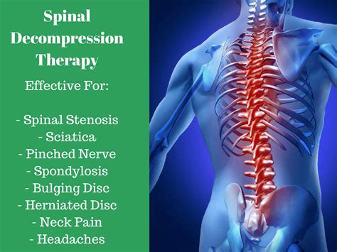 Spinal Decompression Treatment: Available In Wheat Ridge, Arvada and Denver