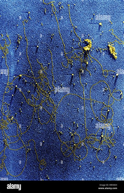 Transmission electron micrograph chloroplast hi-res stock photography and images - Alamy