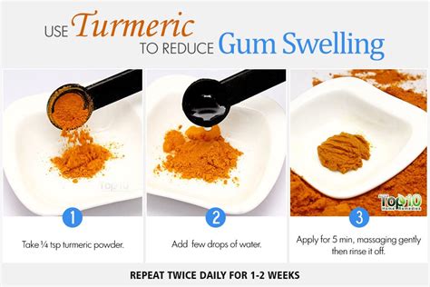 Home Remedies to Reduce Gum Swelling | Top 10 Home Remedies