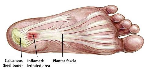 plantar-fascia-foot-anatomy • Bodybuilding Wizard