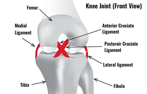 Lateral Collateral Ligament Knee Pain