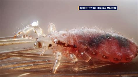 Head lice superbug now resistant to treatment in 25 states - ABC7 New York