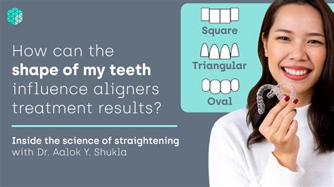 Teeth shapes and sizes: What’s their role in aligner treatment?