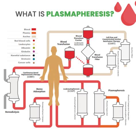 Therapeutic Apheresis - VascuFirst