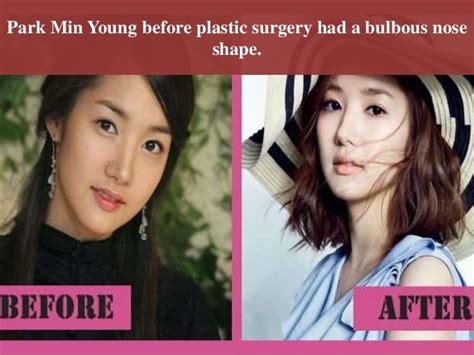 Park min young plastic surgery