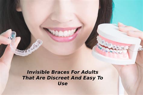 Invisible Braces For Adults That Are Discreet And Easy To Use - 2022