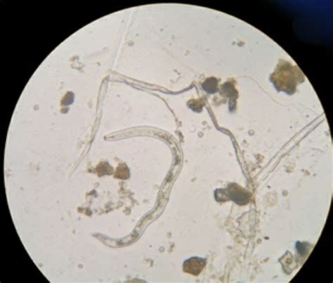 Detection of Plant Nematodes Based on Morphology - Lifeasible