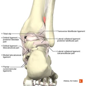 Anterior Tibiofibular Ligament Tear