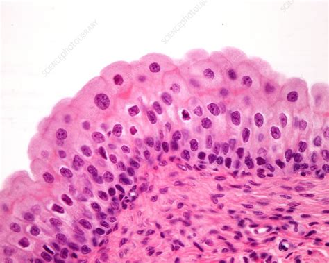 Transitional Epithelium