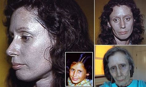 Woman suffers argyria for 60 years after silver built up in her body | Daily Mail Online