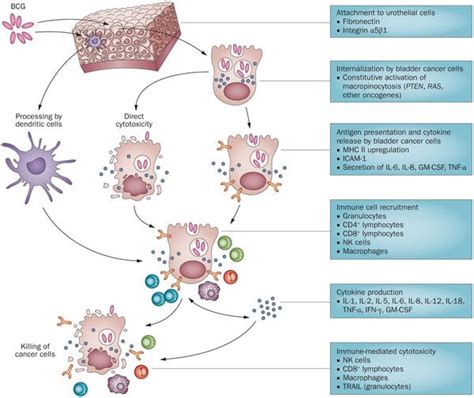 BCG for Urinary Bladder Cancer and BCG sepsis | Epomedicine