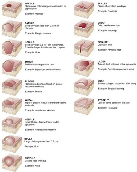 Medical Doctors Worldwide on Instagram: “Different types of skin lesions #medical #dermatology # ...