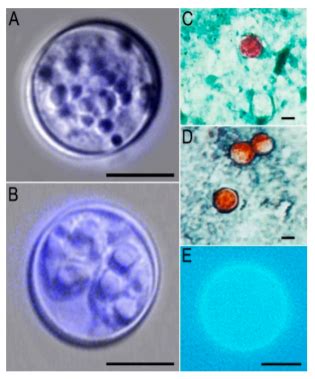 Cyclospora cayetanensis » Clinical Laboratory Science