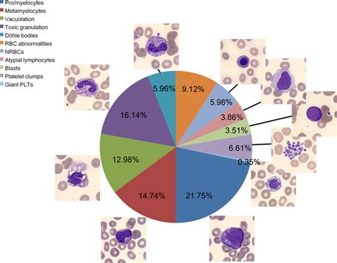 Proportion of morphology abnormality. Among the 285 positive... | Download Scientific Diagram