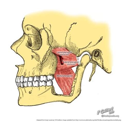 Lateral pterygoid muscle | Image | Radiopaedia.org | Muscle diagram, Myofunctional therapy ...