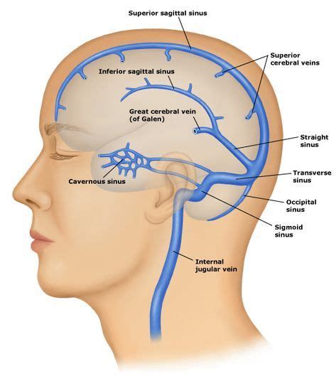 dural venous sinuses | Cerebral (brain) venous thrombosis is uncommon occurring in 1/lac ...