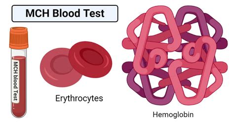 MCH Blood Test- Definition, Calculation, Results, High and Low MCH value