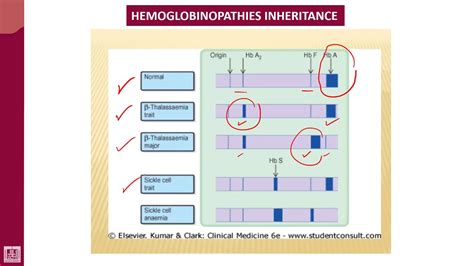 Hemoglobin Electrophoresis Test