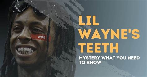 Mystery of Lil Wayne's Teeth: What You Need to Know | Grillz Book