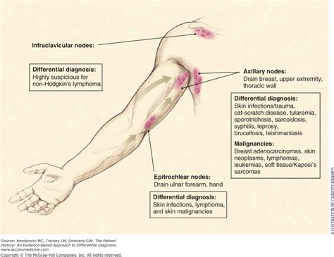 Lymph Nodes Locations In Arms