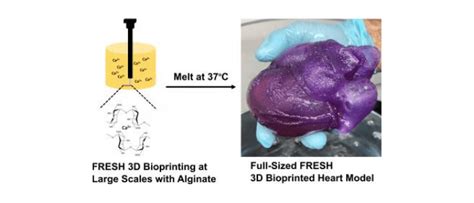 Bioprinted heart for preoperative rehearsal and preparation - RegMedNet