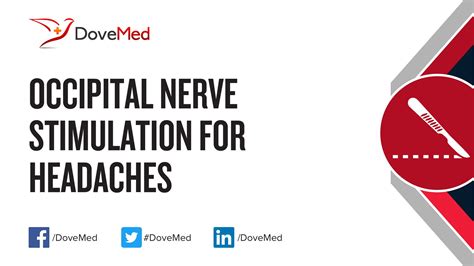 Occipital Nerve Stimulation for Headaches