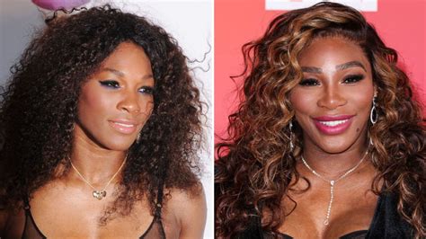 Did Serena Williams Get Plastic Surgery? Before, After Photos | Life ...