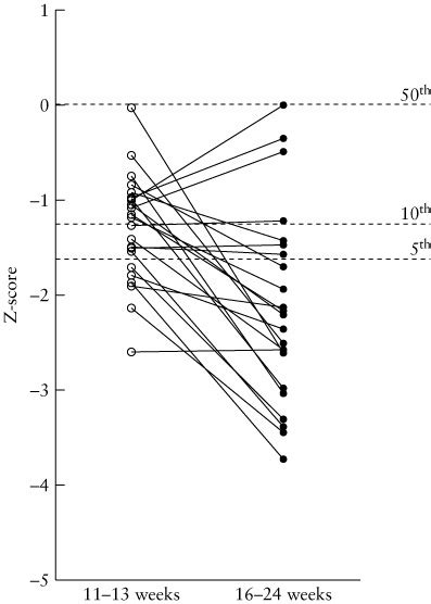 Z-score of biparietal diameter (BPD) measurements in 23 fetuses with... | Download Scientific ...