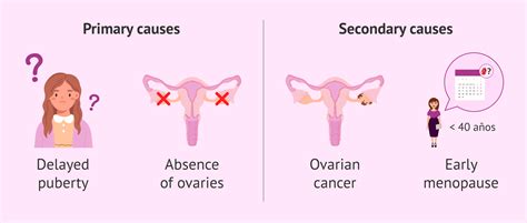 Causes of irregular menstruation