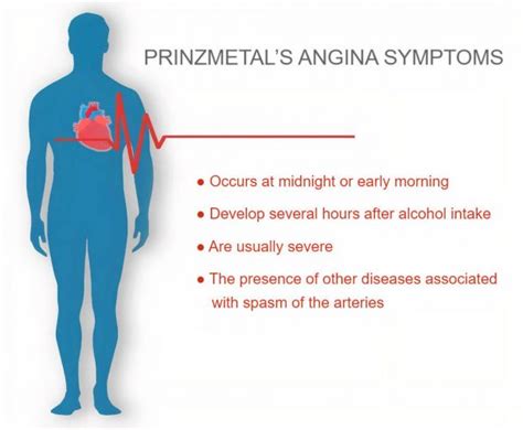 Prinzmetal’s Angina (Variant Angina) | Causes, Symptoms, Diagnosis and Treatment - Page 2 of 5 ...