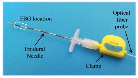 Sensors | Free Full-Text | Recent Advances in Smart Epidural Spinal Needles