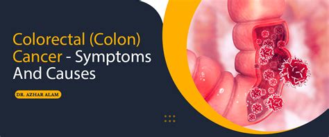 Colorectal (Colon) Cancer - SYMPTOMS AND CAUSES