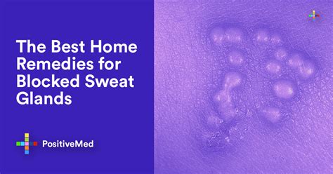 The Best Home Remedies for Blocked Sweat Glands