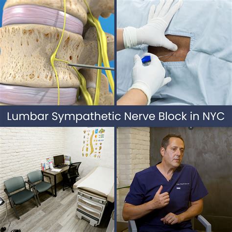 Lumbar Sympathetic Nerve Block in NYC | Back Pain Doctors Specialists