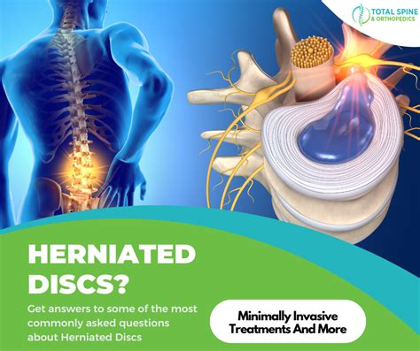 Understanding Herniated Discs: Symptoms and Treatments